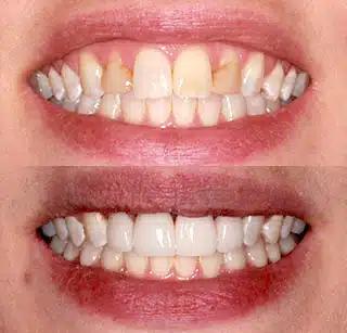 087132b70aa50ab8c2f64d6eeb7060545b21a92b-320x307