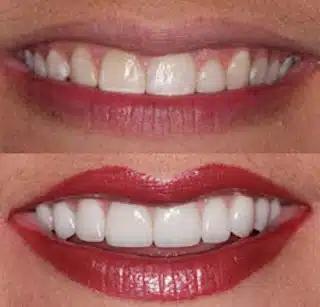 2c44f115577cf65281bcdc23790bd163d8ed964c-320x307