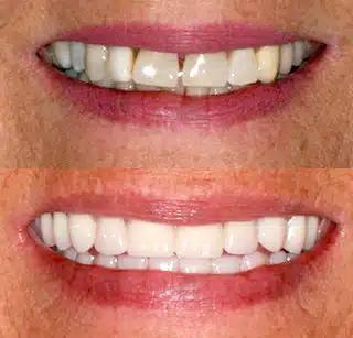 492bb76f136003c50244e841b3884c8f8a9c793e-320x307