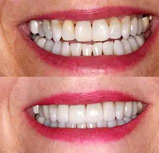 b999ffd09772027b323bec40dfc95728bf2478b3-320x307